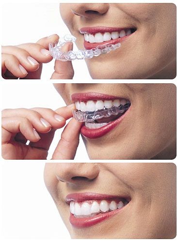 Transparent Treatment Planning
